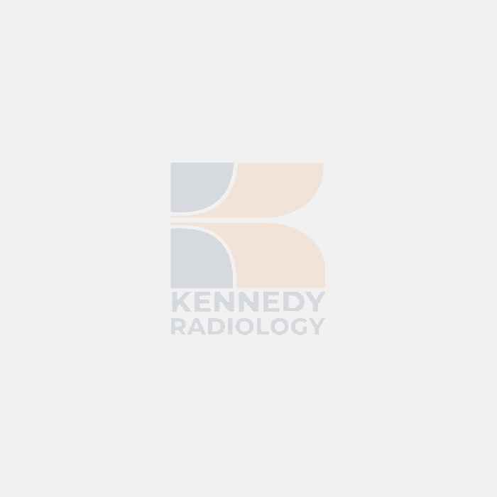 Understanding Gonad Shielding: Safety in X-Rays and Scans